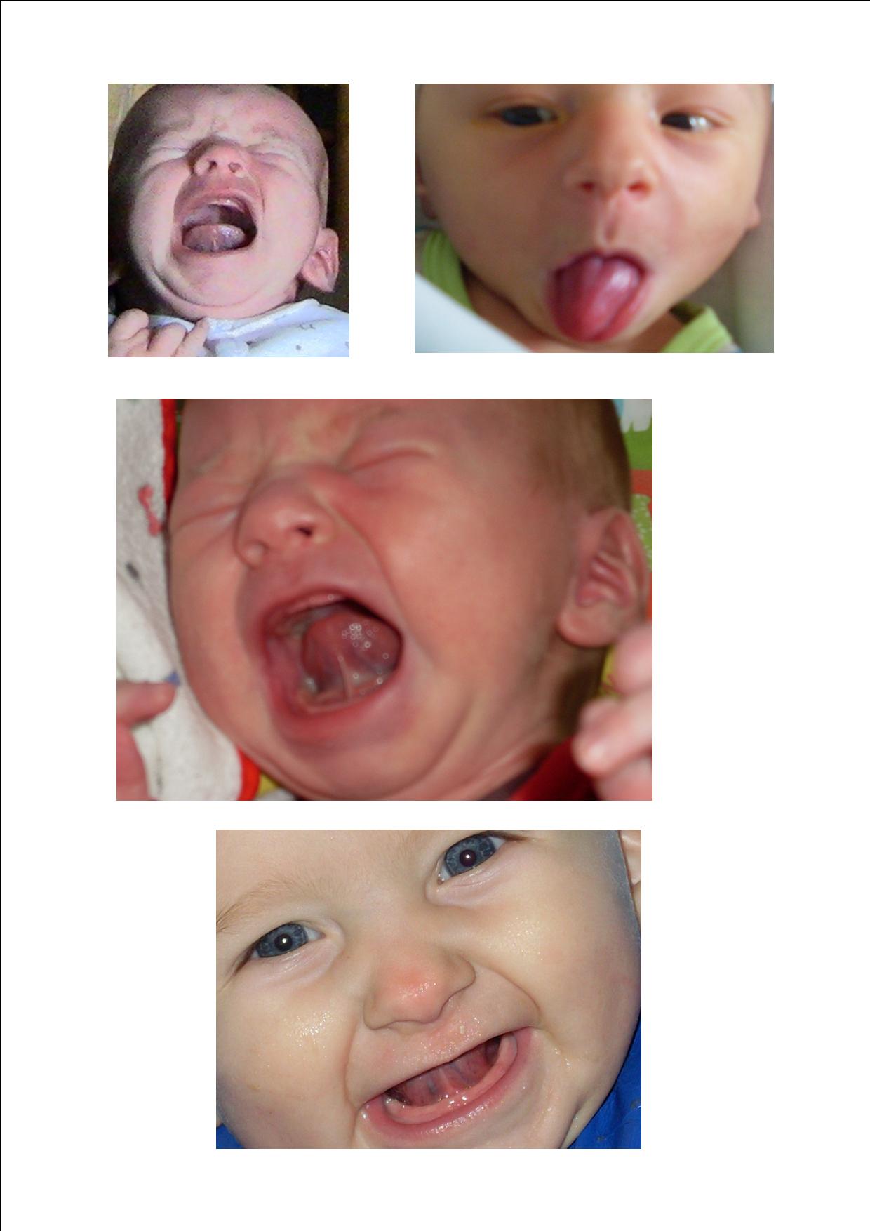 Freins - Bébé Renan