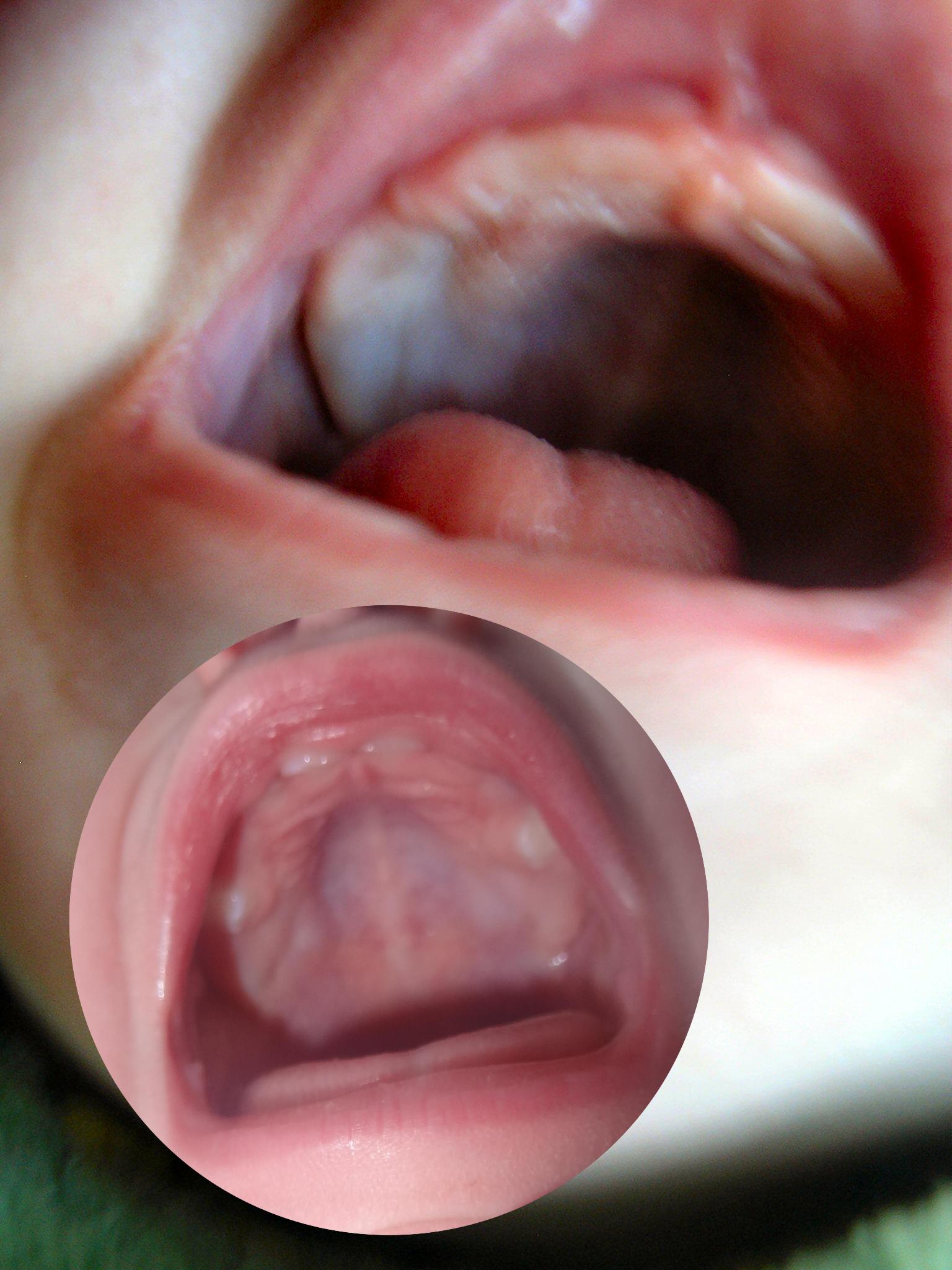 Palais creux - Bébé Eleanore